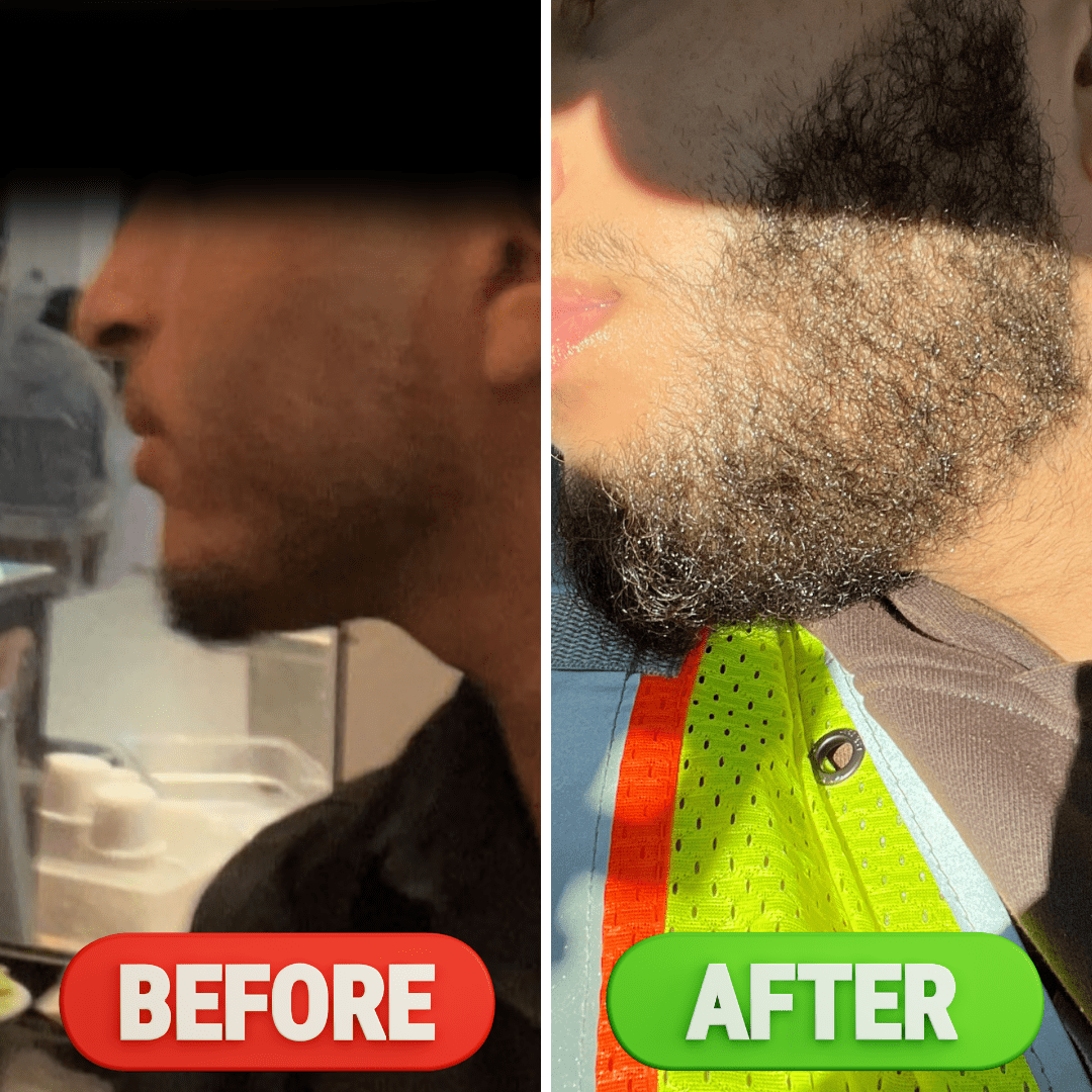 Sea Moss Infused Premium Hair/Beard Growth Oil (All Natural Ingredients)
